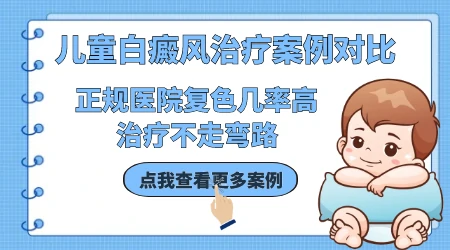 儿童胸口前有点白斑擦什么药
