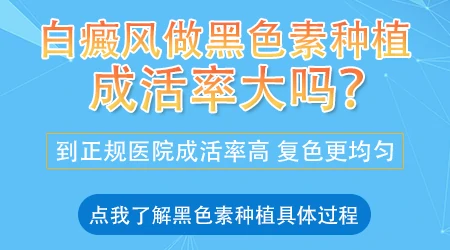 白癜风稳定期黑色素种植的效果