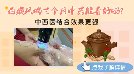 治疗白癜风的中药吃多长时间好