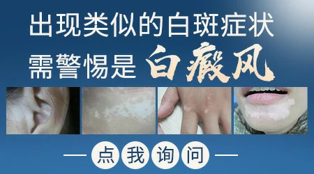 手臂上一个小白圆点不是很白怎么回事