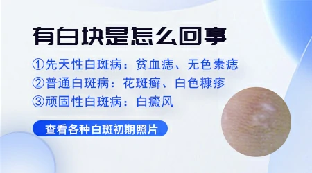 出现白斑有可能是什么