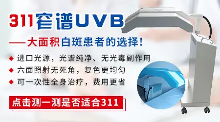 白癜风照uvb白斑处发红正常吗