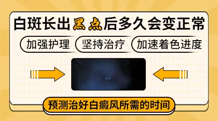 大面积白癜风长出黑色素了多久能治好