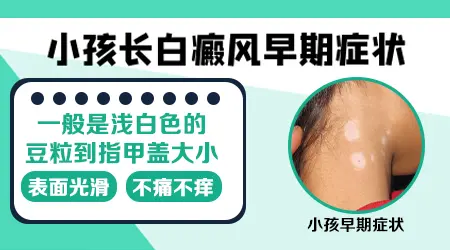 孩子脖子白斑早期症状图片