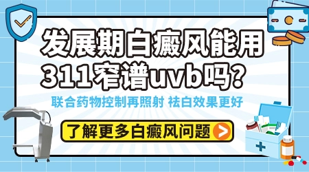 白斑照311可以连续几天照一次