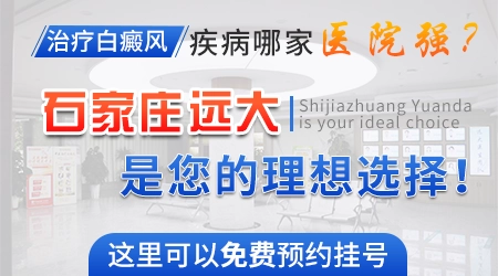 石家庄哪个医院看皮肤白斑最好