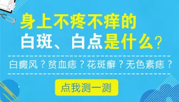 龟头白斑不痛不痒是白癜风吗