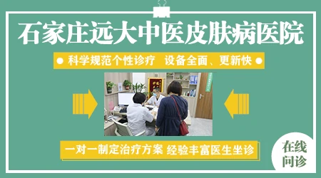 石家庄治疗白癜风医院