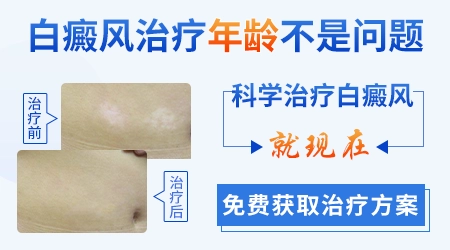 治疗白斑病的食物