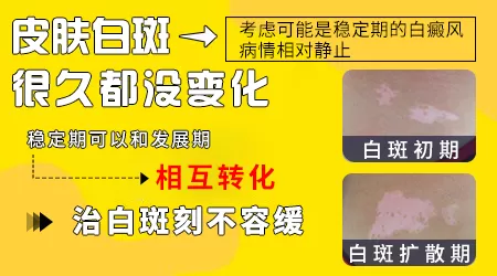 身上一直有浅白色斑好多年了是什么
