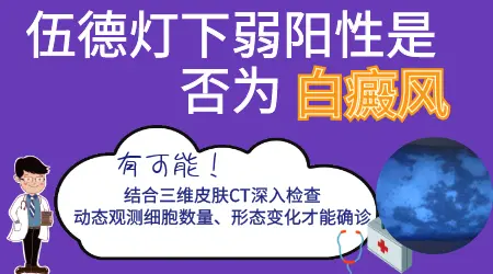伍德灯照射白斑弱阳性什么意思