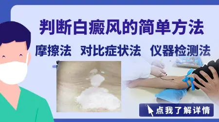 白斑是不是患上了白癜风怎么判断