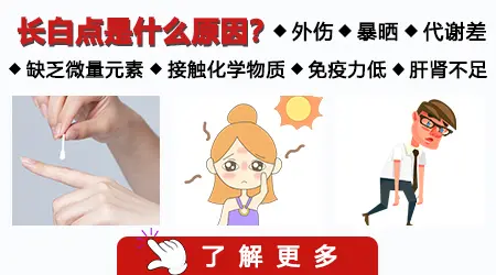 手上长白斑是什么原因造成的