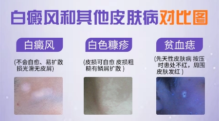 手臂上出现小白斑