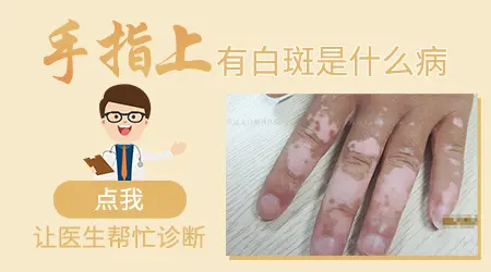 手指末端背面变白