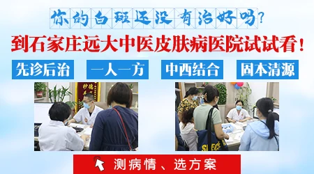 石家庄远大中医皮肤病医院 规范治疗白癜风