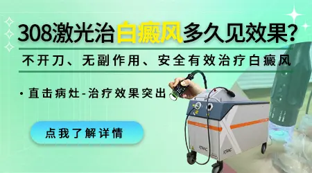 激光308能白癜风吗
