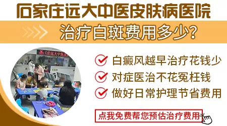 石家庄治白斑贵不贵
