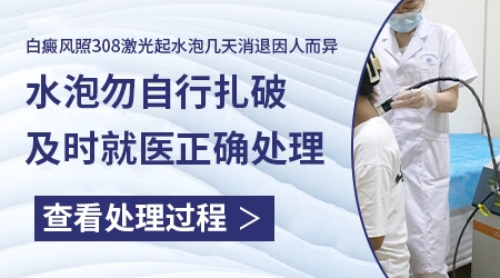 308照白癜风长水泡可以戳破吗