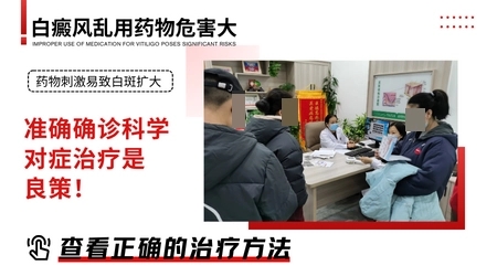 石家庄市治疗白斑的外用药哪种好