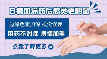 白癜风吃药后白斑明显了