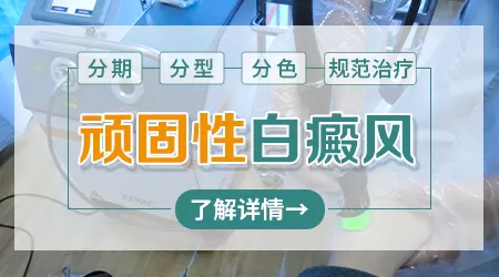 顽固性白癜风怎么治