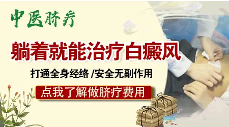 全身都有白癜风怎么治疗