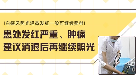 嘴唇长的白斑照光后发红好不好