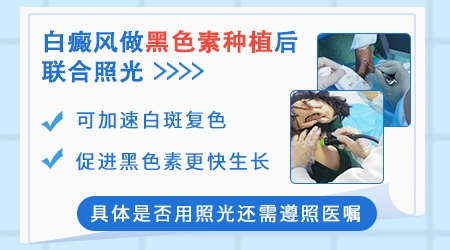 黑色素移植多久可以恢复正常皮肤