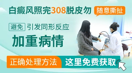 白癜风做308激光后脱皮正常吗