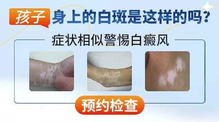 6岁小孩脸上长小白点点