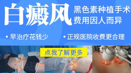 黑色素细胞种植治疗白癜风的好处