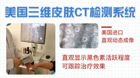 白癜风抹药发红了