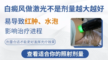 自己在家照射白癜风用多大的剂量好