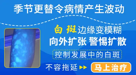 嘴唇白癜风照308激光多长时间能好