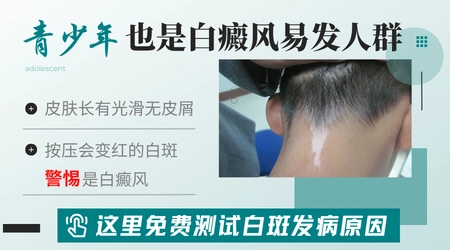 高中生身上有白斑是什么原因引起的