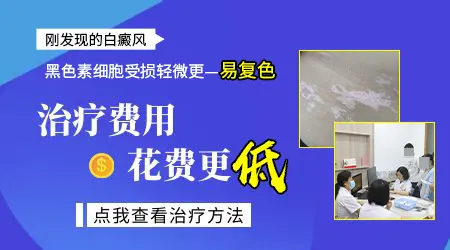 白癜风治疗费用高不高