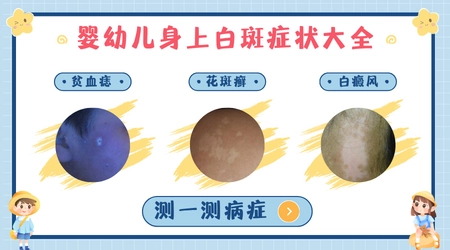 婴幼儿皮肤突然出现白斑