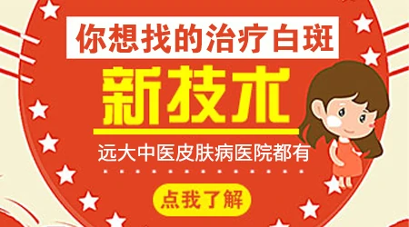 现在白癜风有什么吗