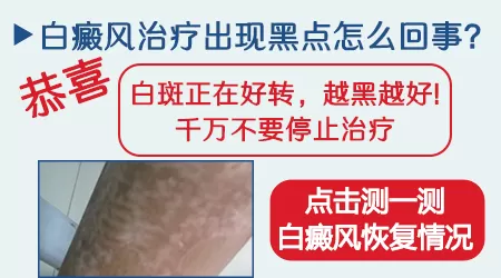 白斑照了308光疗后中间有黑点正常吗
