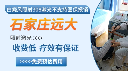 308激光照白癜风一个光斑多少钱
