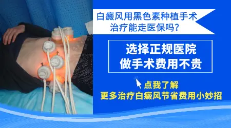 白斑几年了都没有变化是不是没事