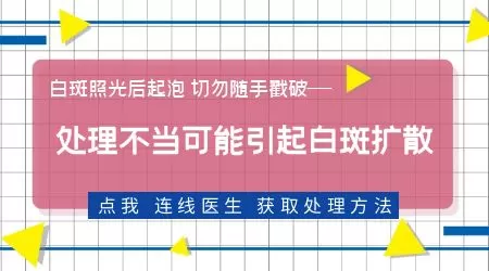 白癜风照308激光起小泡了怎么办