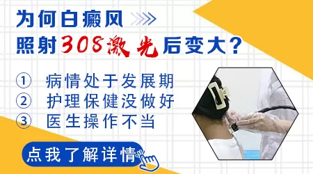 白癜风照激光后没好又变大了咋回事
