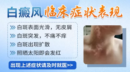 汗斑和白斑图片对比