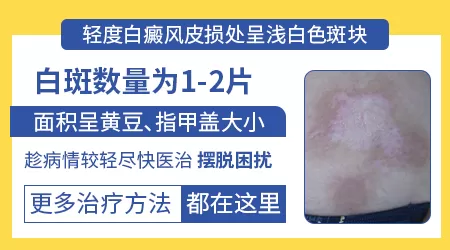 白斑初期症状图是什么样的