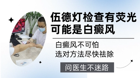 伍德氏灯下白斑有荧光代表什么