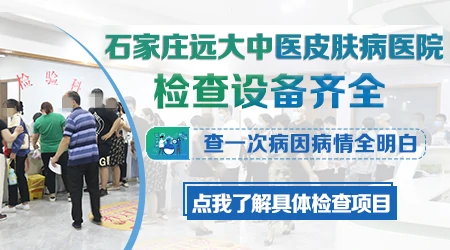检查白斑哪家医院能做皮肤ct