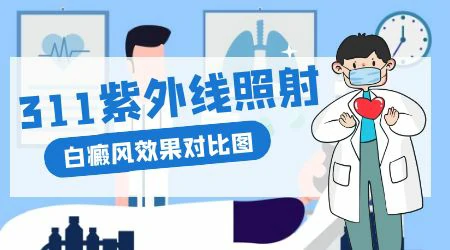 UVB灯能治疗白癜风吗