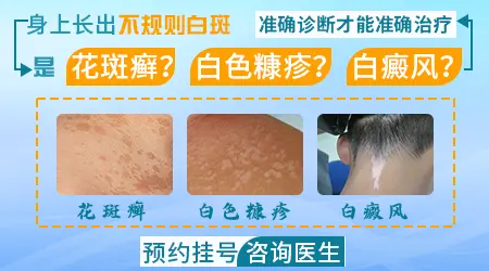 早期白斑识别图片